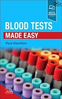Blood Tests Made Easy | آزمایش خون آسان شد